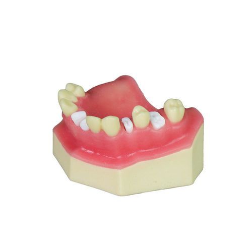 Anatomisches Modell / Nebenhöhle - JG-Y8-F5 - FOSHAN JINGLE MEDICAL EQUIPMENT CO., LTD - Dental / Zahnfleisch / Oberkiefer