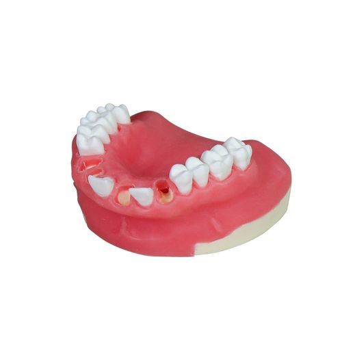 Anatomisches Modell / Unterkiefer - JG-Y8-F2 - FOSHAN JINGLE MEDICAL EQUIPMENT CO., LTD - Zahn / Zahnfleisch / chirurgisch