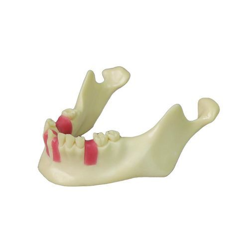 Anatomisches Modell / Unterkiefer - JG-Y12-TG - FOSHAN JINGLE MEDICAL EQUIPMENT CO., LTD - für Implantologie / Ausbildung / Schaumstoff