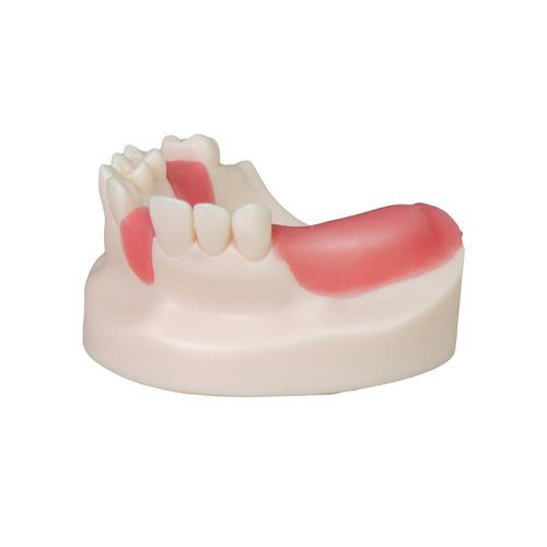 Anatomisches Modell / Zahn - JG-Y8-F6 - FOSHAN JINGLE MEDICAL EQUIPMENT CO., LTD - Zahnfleisch / chirurgisch / für Implantologie