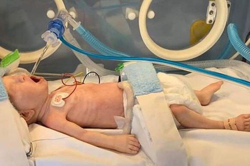 Atemwegsmanagement-Patientensimulator - PREM & FULL TERM - LifeCast Body Simulation Ltd - für CPR / für pädiatrische Betreuung / Baby