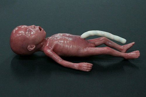 Trainingspuppe für pädiatrische Betreuung - MICRO-PREEMIE - LifeCast Body Simulation Ltd - Pneumothorax / Baby / Silikon