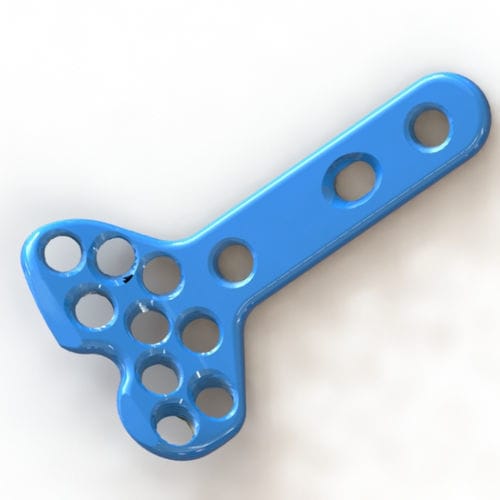Kompressionsplatte für Radius - 1306-4820 - SurgTech - distal / mit Verriegelung / Titan