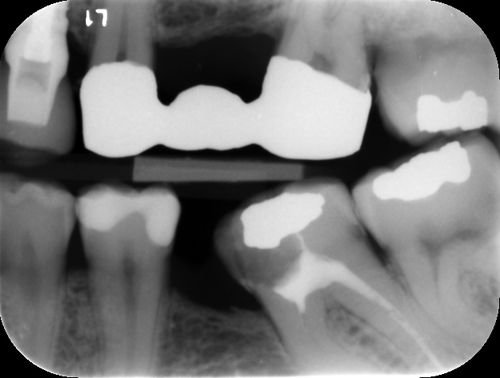 Software zur Kariesfeststellung - ORCA DENTAL AI - Bildanalyse / Diagnose / für Kliniken