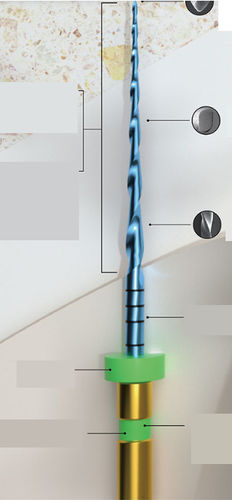 Dentalbohrer - E-FLEX ONE - Changzhou Sifary Medical Technology - Metall / gerade