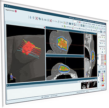 Behandlungsplanungssoftware - SagiPlan® - BEBIG MEDICAL GmbH - Bewertung / Computertomographie / MRT