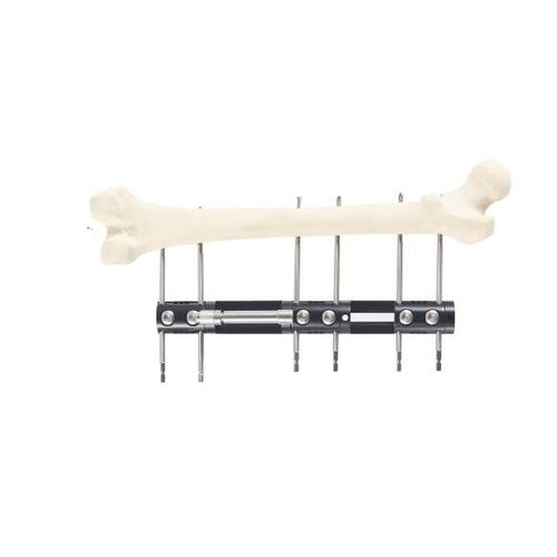 Fixateur externe / für Tibia - Wuhan Yijiabao Biological Materials - für Radius / rohrförmig / für Erwachsene