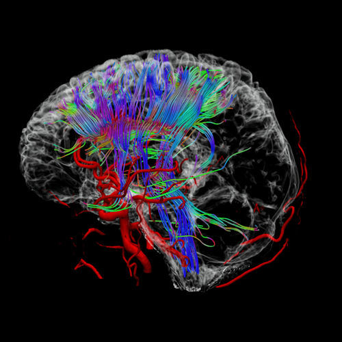 Analysesoftware - uVIEWER - Shanghai United Imaging - Visualisierung / Umform / medizinisch