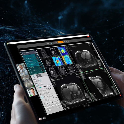 Management- und Kommunikationssystem / Visualisierung - uOmniscan - Shanghai United Imaging - für DCIM-Datei / für PACS / Video