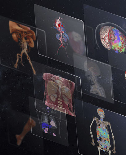 Medizinische Software - uOmnispace - Shanghai United Imaging - OP / Kardiologie / Computertomographie