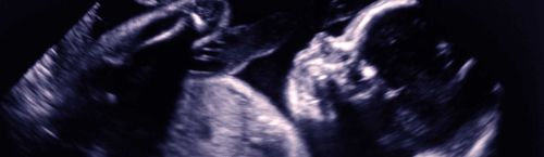 Analysesoftware - Congenica Prenatal™ - Congenica Ltd - Diagnose / medizinisch / für Kliniken