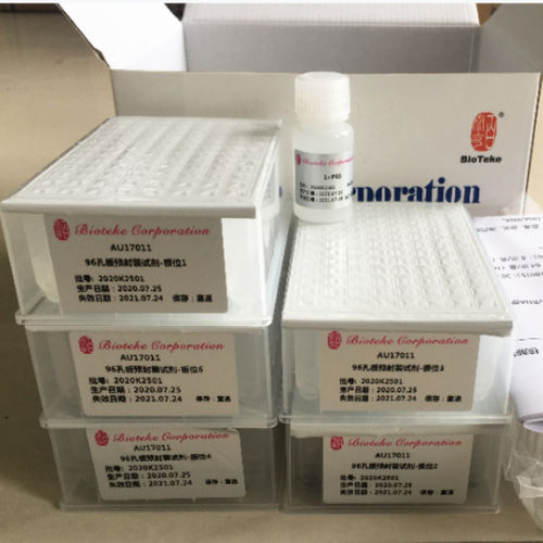 Reagenzkit zur Proteinreinigung - DP171 series - Bioteke Corporation - als Lösung / Pufferlösung / Serum