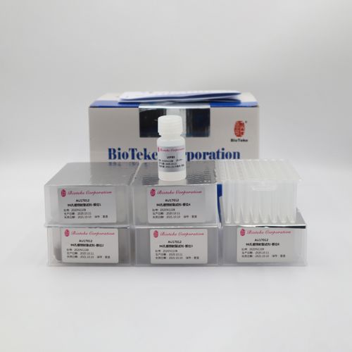 Färbelösungs-Reagenzkit - AU17012 - Bioteke Corporation - Magnetkugeln / Serum / Plasma