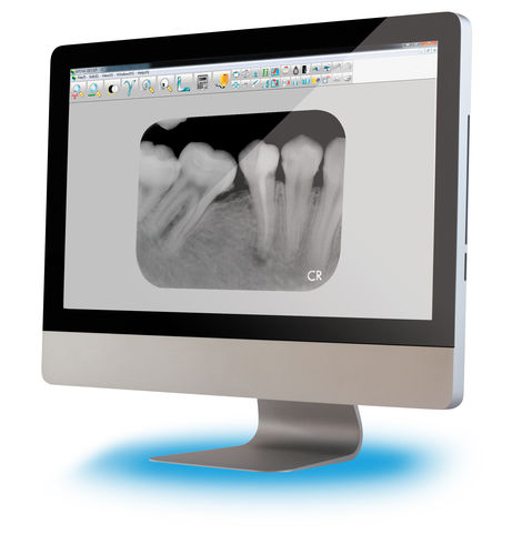 Software für dentale Bildgebung - Apixia - Viewer / Umform / Dental