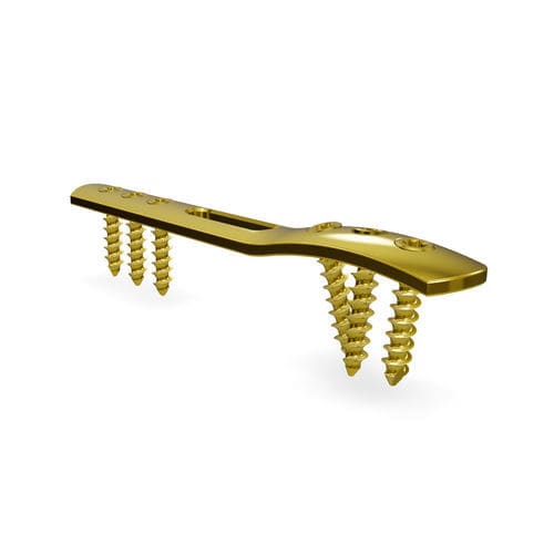 Kompressionsplatte für Malleolus - Malleolus 3.5 locking compression plate - Astrolabe - distal / seitlich / mit Verriegelung