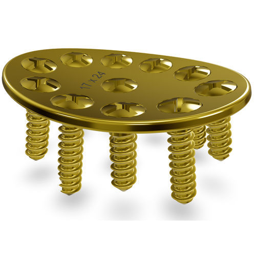 Arthrodeseplatte für Handwurzelknochen - CMS 2.3 Modular System - Astrolabe - medial / mit Verriegelung / Titan