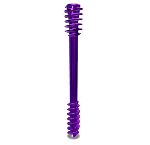 Knochen-Kompressionsschraube / für Fuß - CCBS 6.0 mm - Astrolabe - für Humerus / für Oberschenkelknochen / für Tibia
