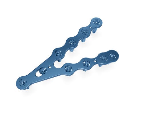 Kompressionsplatte für Radius - SMA 2,7 mm System  - Astrolabe - distal / mit Verriegelung / Metall