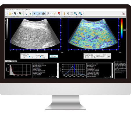 Software für Ultraschalluntersuchungen - AmCAD-US - AmCad BioMed - Visualisierung / Diagnose / Interpretation