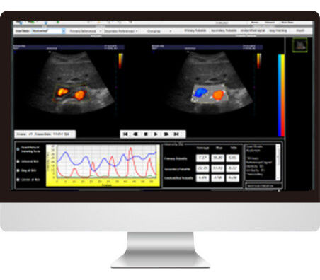 Bildanalyse-Software - AmCAD-UV  - AmCad BioMed - Interpretation / für Ultraschalluntersuchungen / Blutgefäße