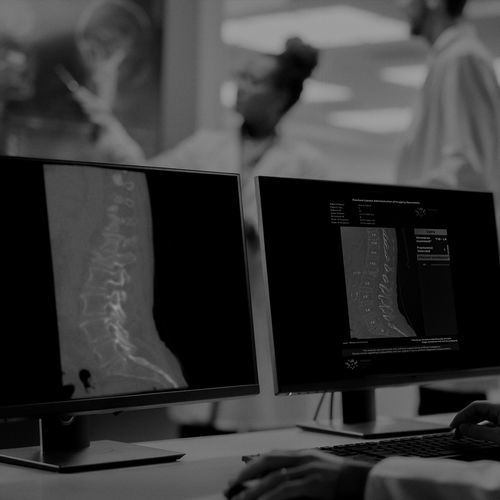 Software zur Frakturerkennung - IB Lab FLAMINGO - Imagebiopsy Lab - Umform / KI-gestützt / medizinisch