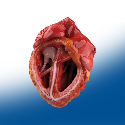 Anatomisches Herzmodell - Ortho Baltic - chirurgisch / Ausbildung