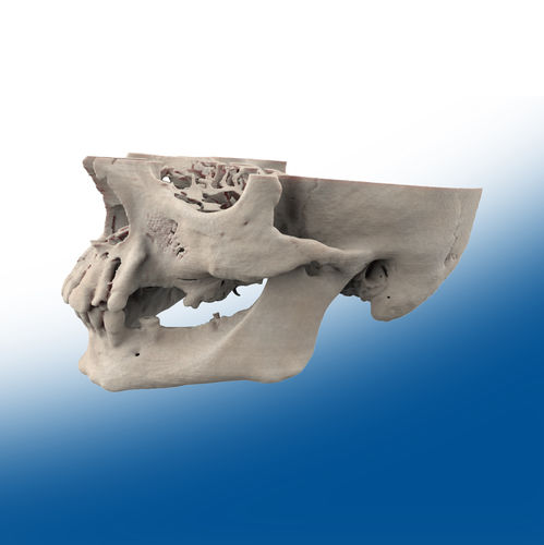 Anatomisches Modell / Unterkiefer - Ortho Baltic Implants - chirurgisch / Ausbildung