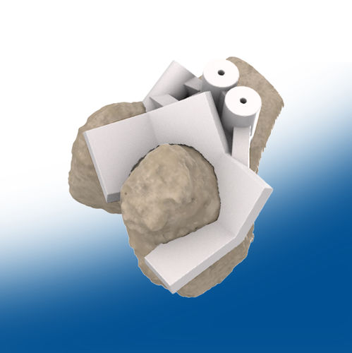 Hüftprothese Schneidschablone - 3D - Ortho Baltic