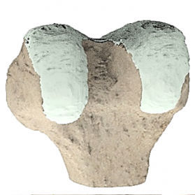 Anatomisches Modell / Knie - Ortho Baltic Implants - chirurgisch