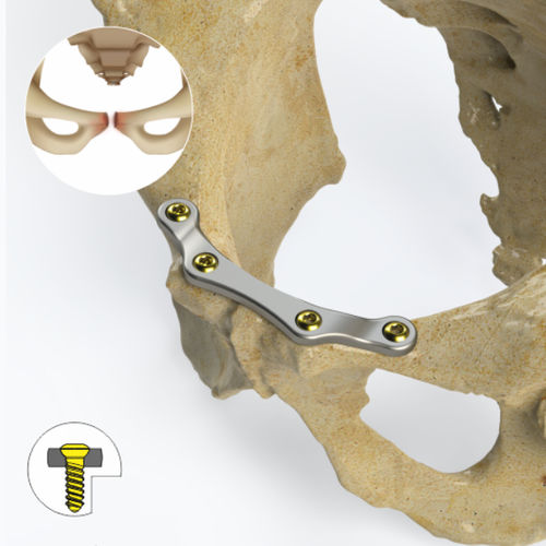 Kompressionsplatte für Becken - 9742 series - Zimed Medical - mit Verriegelung / Metall