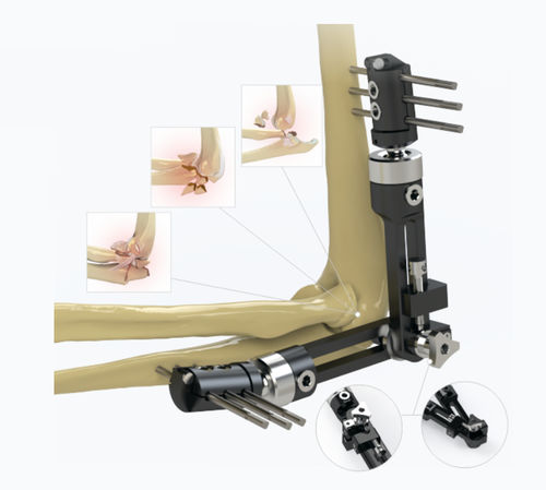 Fixateur externe / für Ellbogen - 5934-0000 - Zimed Medical - rohrförmig / für Erwachsene