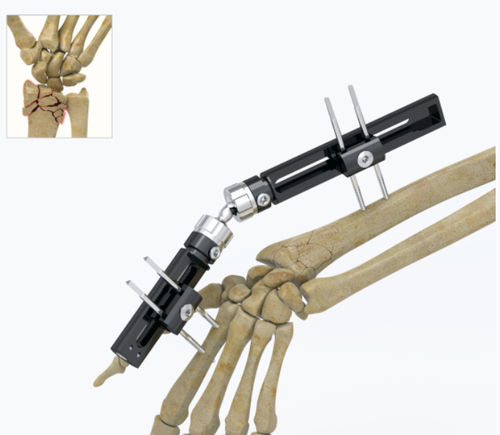 Fixateur externe / für Handgelenk - 5034 series - Zimed Medical - rohrförmig / für Erwachsene