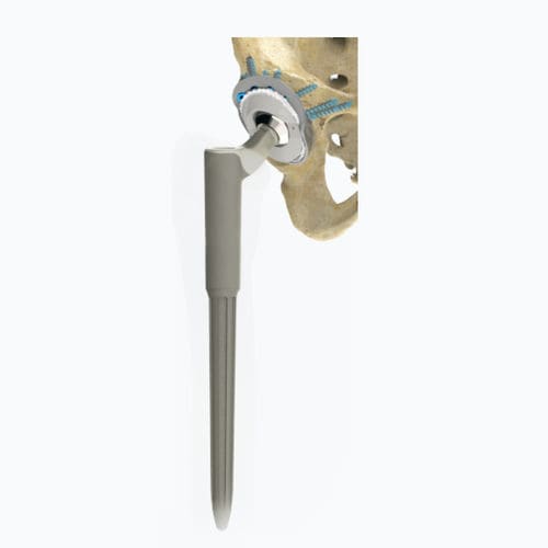 Revisions-Hüftprothese - Zimed Medical - zementfrei