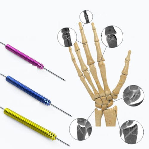 Knochen-Kompressionsschraube / für Hand - Zimed Medical - kanüliert / ohne Kopf / Metall