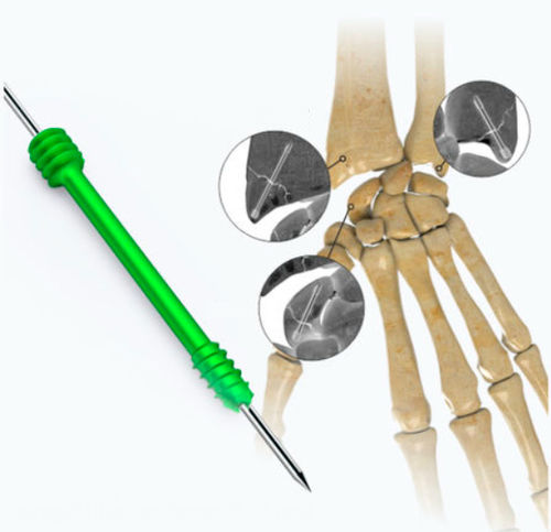 Knochen-Kompressionsschraube / für Hand - Zimed Medical - kanüliert