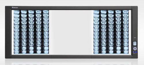 Digitaler Röntgenfilmbetrachter - ZG-3 - Hunan Mplent Optoelectronics Technology - 3 Betrachtungsflächen / mit Schalter / LED
