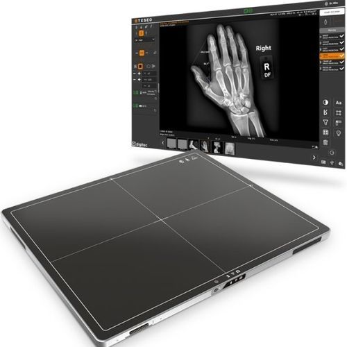 Flachbilddetektor für multifunktionale Röntgenaufnahmen - TeseoX - Digitec - tragbar / kabellos