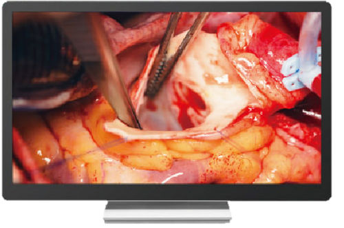Diagnose-Monitor - imedtac - OP / 4K / 32"