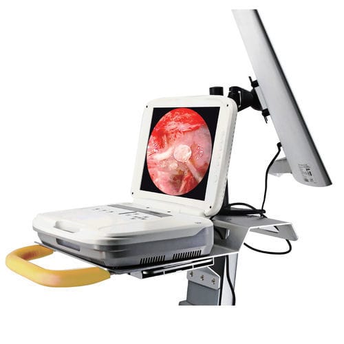Endoskopie-Wagen / für endoskopische Neurochirurgie - 1080P - Hotry
