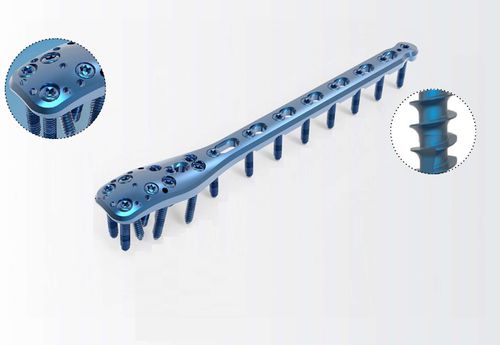 Kompressionsplatte für Humerus - TRUE LOCK Proximal Humerus - Truemed Medical - proximal / mit Verriegelung / Metall