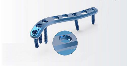 Kompressionsplatte für Humerus - TRUE LOCK Proximal Humerus - Truemed Medical - distal / seitlich / mit Verriegelung
