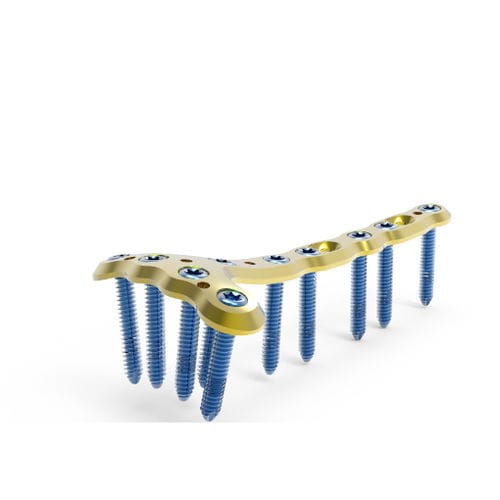 Kompressionsplatte für Tibia - TRUE LOCK Distal Tibia Anterior - Truemed Medical - distal / mit Verriegelung / Metall