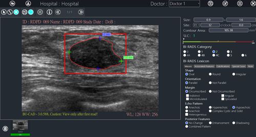 Bildanalyse-Software - BU-CAD™ - TaiHao Medical - Reporting / Diagnose / Interpretation