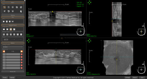 Reporting-Software - BR-Viewer™ - TaiHao Medical - Viewer / Diagnose / zur Brustkrebs-Früherkennung