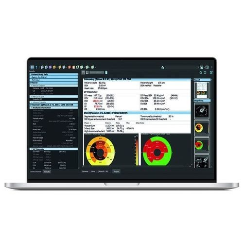 Analysesoftware - SPHERE® 3.0 - Olea Medical - Visualisierung / Mess / kardiologisches Mapping