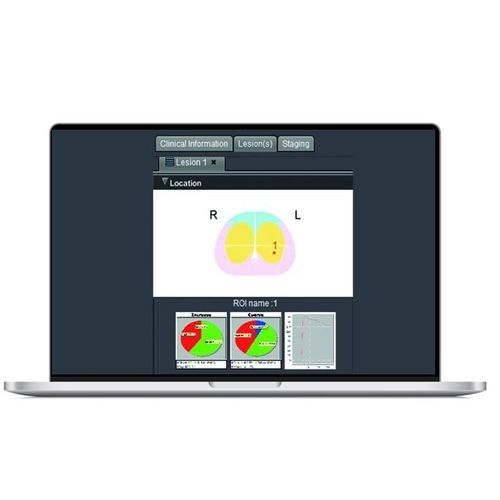 MRT-Software - SPHERE® 3.0 - Olea Medical - Mess / Bildanalyse / Datenanalyse