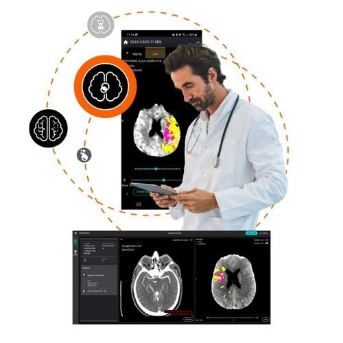 Bildanalyse-Software - Olea Medical - medizinisch / Computertomographie / Lungen
