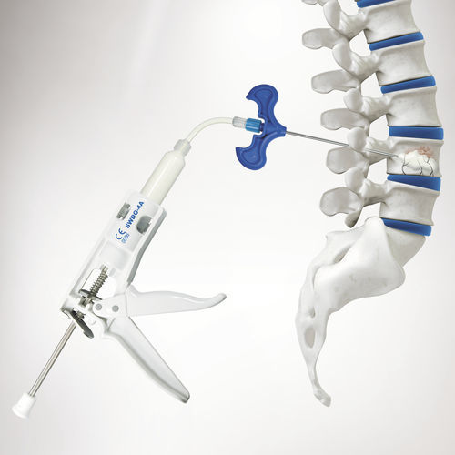 Instrumentenset zur Injizierung von Knochenzement - SPASY BCD ™  - Seawon Meditech