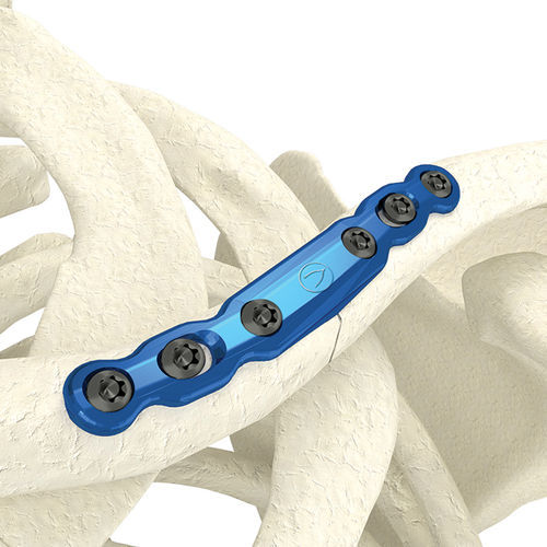 Kompressionsplatte für Schlüsselbein - PK-SMC0635NL-TI - WishBone Medical - medial / Metall / für Kinder