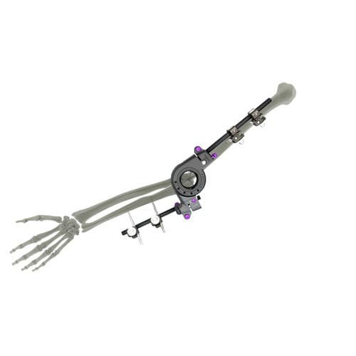 Fixateur externe / für Ellbogen - UniX® - WishBone Medical - rohrförmig / für Erwachsene